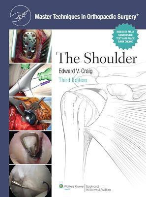 Master Techniques in Orthopaedic Surgery: Shoulder(English, Hardcover, Craig Edward V MD)