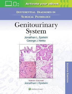 Differential Diagnoses in Surgical Pathology: Genitourinary System(English, Hardcover, Epstein Jonathan)