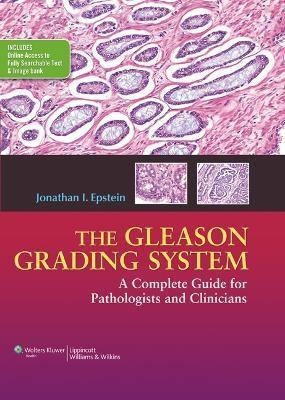 The Gleason Grading System(English, Hardcover, Epstein Jonathan I.)