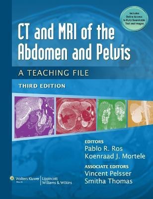 CT & MRI of the Abdomen and Pelvis(English, Paperback, unknown)