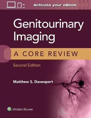 Genitourinary Imaging: A Core Review(English, Paperback, Davenport Matthew S.)