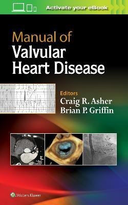 Manual of Valvular Heart Disease(English, Paperback, Asher Craig R. MD, FACC)