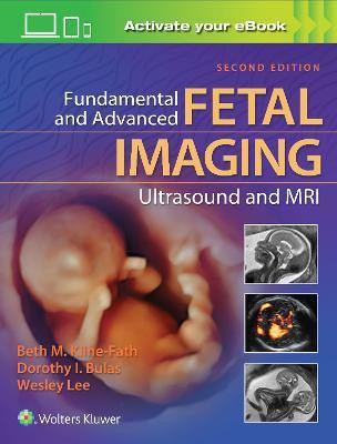 Fundamental and Advanced Fetal Imaging Ultrasound and MRI(English, Hardcover, Kline-Fath Beth Dr. MD)