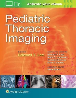 Pediatric Thoracic Imaging(English, Hardcover, Lee Edward Y.)