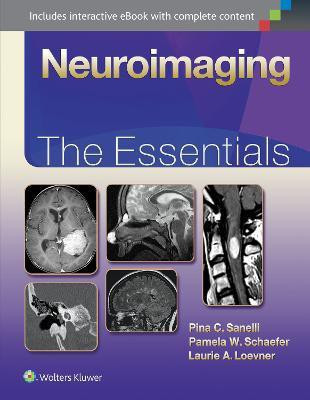 Neuroimaging: The Essentials(English, Hardcover, Sanelli Pina MD, FACR)