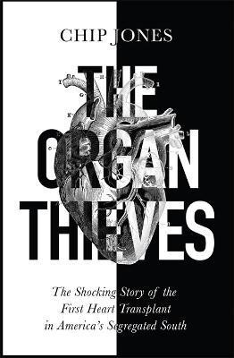 The Organ Thieves(English, Paperback, Jones Chip)