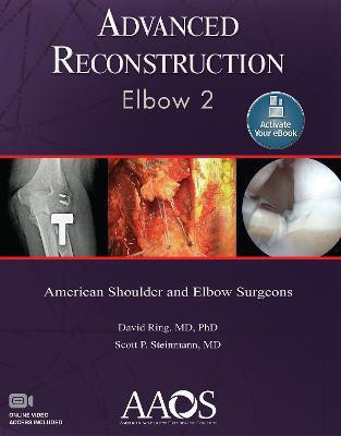 Advanced Reconstruction: Elbow 2: Print + Ebook with Multimedia(English, Hardcover, unknown)