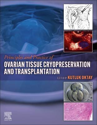 Principles and Practice of Ovarian Tissue Cryopreservation and Transplantation(English, Hardcover, unknown)