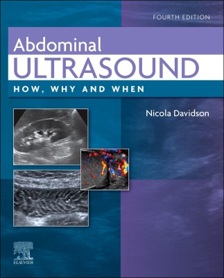 Abdominal Ultrasound(English, Hardcover, unknown)