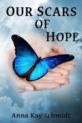 Our Scars of Hope(English, Paperback, Schmidt Anna Kay)