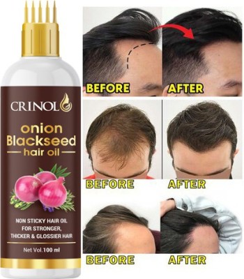 crinol Black Seed Onion Hair Oil Controls Hair Fall  Hair Oil(100 ml)