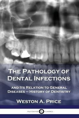 The Pathology of Dental Infections(English, Paperback, unknown)