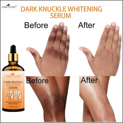 PARK DANIEL Whitening Serum For Remove Dark Knuckles Elbow & Knee Pack of 3 (30 ml) Men & Women(90 ml)