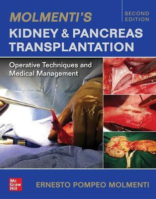 Molmenti's Kidney and Pancreas Transplantation: Operative Techniques and Medical Management(English, Hardcover, Molmenti Ernesto P.)