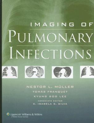 Imaging of Pulmonary Infections(English, Hardcover, unknown)
