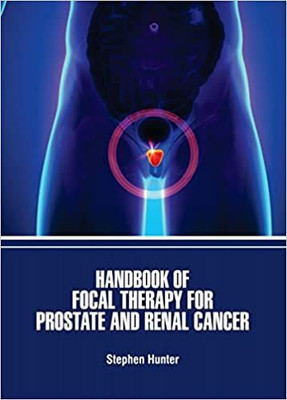 HANDBOOK OF FOCAL THERAPY FOR PROSTATE AND RENAL CANCER (HB 2022)(Hardcover, HUNTER S.)
