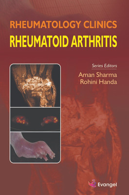 Rheumatology Clinics Rheumatoid Arthritis(Hardcover, Aman Sharma, Rohini Handa)