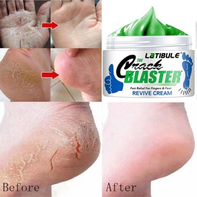 Latibule Foot Crack Cream For Dry Cracked Heels & Feet(50 g)