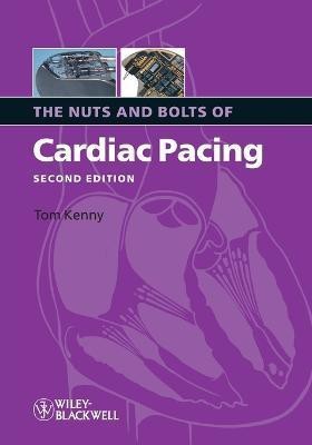 The Nuts and Bolts of Cardiac Pacing(English, Paperback, Kenny Tom)