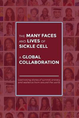 The Many Faces and Lives of Sickle Cell - A Global Collaboration(English, Hardcover, Nsofwa Agnes)