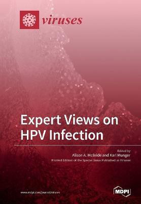 Expert Views on HPV Infection(English, Paperback, unknown)