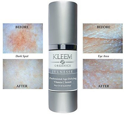 

Kleem Organics Anti Aging Vitamin C Serum For Face With Ferulic And Hyaluronic Acid(200 g)