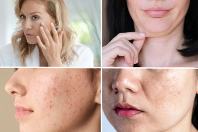 Libline Face Serum, Increases Skin's Glow Instantly and Reduces Spots(14 ml)