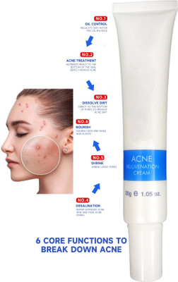 tanvi27 Remove and Lighten Old and New Scars, Spots and Marks(30 g)