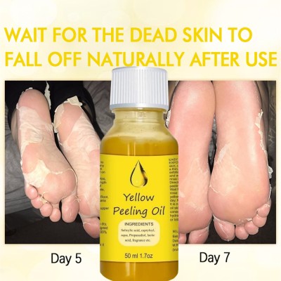 REGLET Whitening Yellow Peeling Oil for Full Body Brighteninig(50 ml)