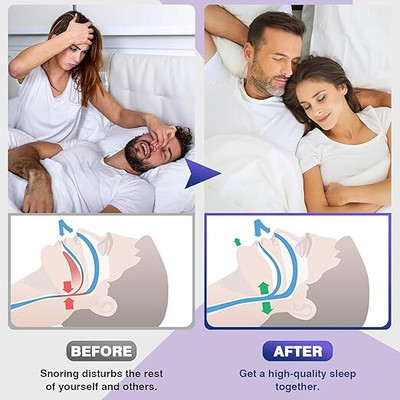Mallade K_ML_SN_BC Anti-snoring Device(Nose Clip)