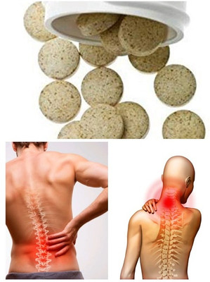 ZYREX Spondylitis Cure Tablets-180 Tablets Pack.Herbal and Result Oriented.(180 Tablets)