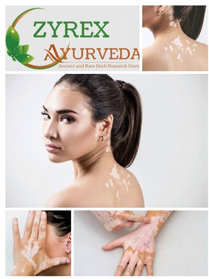 ZYREX Vitiligo Nill Tablets-120 Tablets Pack.Pure Herbal and Result Oriented(120 Tablets)