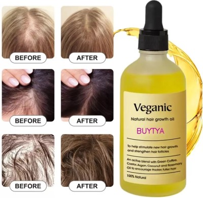 Buy TYA Restore Your Hairline & Confidence Veganic Rosemary Hair Growth Solution(60 ml)