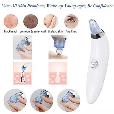 Elecsera Plastic Blackhead Remover Vacuum Suction Device(Pack of 4)