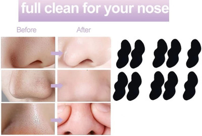 REIMICHI Charcoal Nose Strip for Whiteheads & Blackheads Remover Strips(10 Strips)