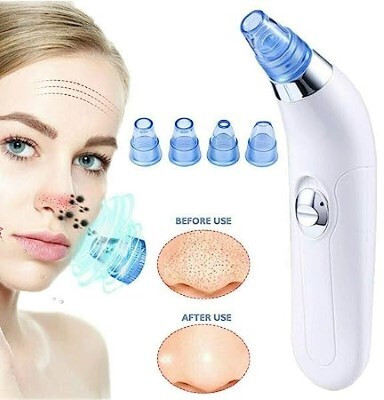 Rishikaenterprises Plastic Blackhead Remover Vacuum Suction Device(Pack of 4)
