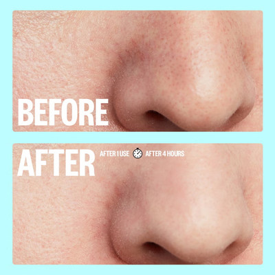 manasona Paper Blackhead Remover Strips(Pack of 10)