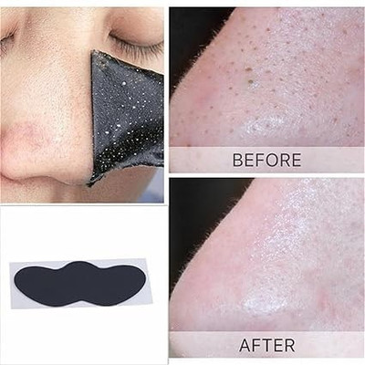 imelda Paper Blackhead Remover Strips(Pack of 10)