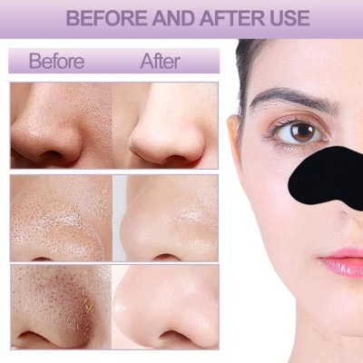 Squzaz Blackhead Remover Bamboo Charcoal Nose Strips(5 g)