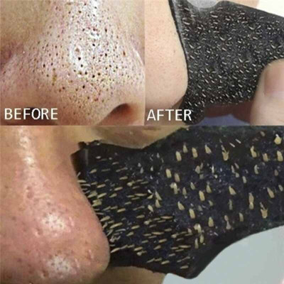 manasona Charcoal Painless & Instant Removal Blackhead Nose Pore Strips(10 g)