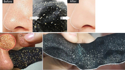 manasona Paper Blackhead Remover Strips(Pack of 10)