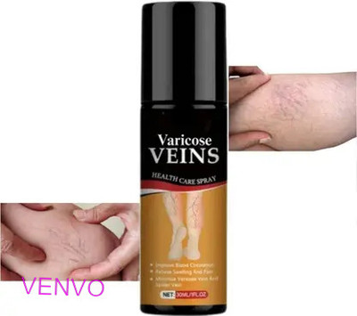 venvo Cooling Leg Vein Mist For Men And Women Spray(100 ml)
