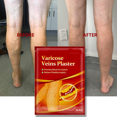 vvqvv Herbal Vein Care Patch – For Throbbing & Aching Legs Plaster & Patch(10 x 10 g)