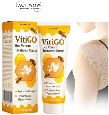 ACTIWOW Vitigo Bee Venom Cream for Balanced Daily Use Z01 Cream(100 g)