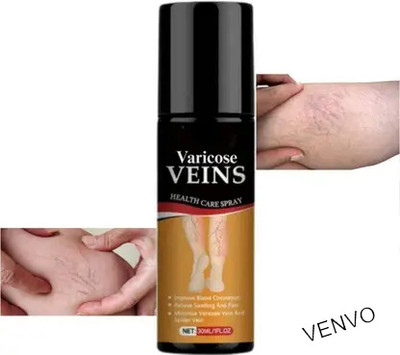 venvo Fast Absorbing Varicose Vein Mist Spray(100 ml)
