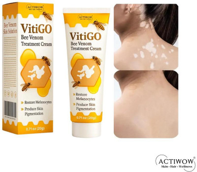 ACTIWOW Vitigo Bee Venom Cream for Gentle Daily Balance Z01 B01 B01 Cream(100 g)