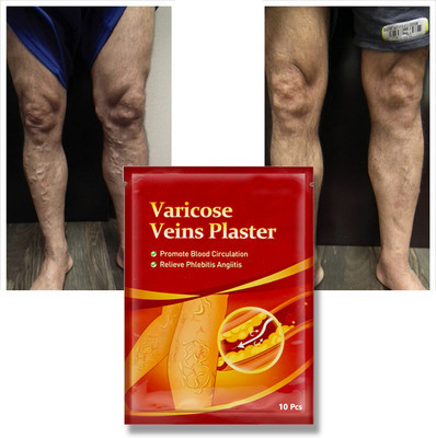 nandurba Herbal Vein Care Patch – For Throbbing & Aching Legs Plaster & Patch(10 x 10 g)