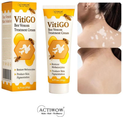 ACTIWOW Vitigo Bee Venom Cream for Anti-Blemish Glow Z01 Cream(100 g)