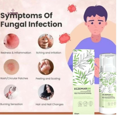 LORSHEL Eczemaron Anti-Fungal Cream for Fungal Infection Relief Solution(50 ml)