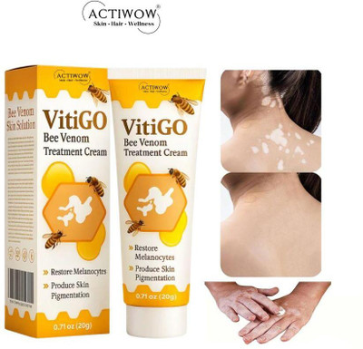 ACTIWOW Vitigo Bee Venom Cream for Night Repair Rituals Z01 Cream(100 g)